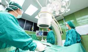 Medici operazione sala operatoria